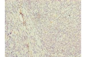 Immunohistochemistry of paraffin-embedded human tonsil tissue using ABIN7142250 at dilution of 1:100