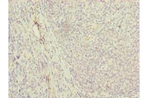 Immunohistochemistry of paraffin-embedded human tonsil tissue using ABIN7142250 at dilution of 1:100 (MRPS16 anticorps  (AA 1-137))
