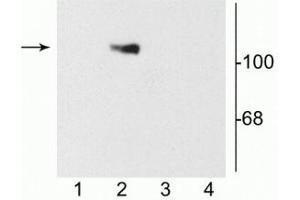 Western blot of 10 µg of HEK 293 cells showing specific immunolabeling of the ~120 kDa NR1 subunit of the NMDA receptor containing the C2 splice variant insert (lane 2). (GRIN1/NMDAR1 anticorps)