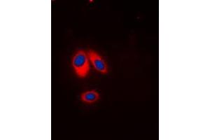 Immunofluorescent analysis of p47 phox (pS359) staining in HeLa cells. (NCF1 anticorps  (C-Term, pSer359))