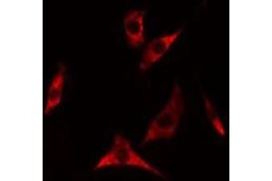 ABIN6275318 staining A549 cells by IF/ICC. (NARFL anticorps  (Internal Region))