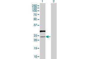 Western Blot analysis of RAB7L1 expression in transfected 293T cell line by RAB7L1 MaxPab polyclonal antibody. (RAB7L1 anticorps  (AA 1-203))