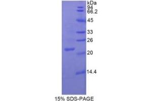 SDS-PAGE of Protein Standard from the Kit (Highly purified E.