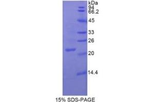 SDS-PAGE of Protein Standard from the Kit (Highly purified E. (ENOS Kit ELISA)