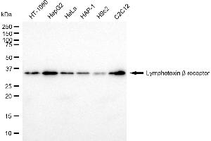 Western blotting analysis using lymphotoxin beta receptor antibody (ABIN7799297).