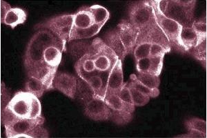 Immunofluorescence staining of MCF7 cells (Human breast adenocarcinoma, ATCC HTB-22).