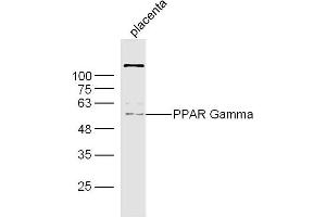 Mouse Placenta lysates probed with PPAR Gamma Polyclonal Antibody, Unconjugated  at 1:300 dilution and 4˚C overnight incubation.