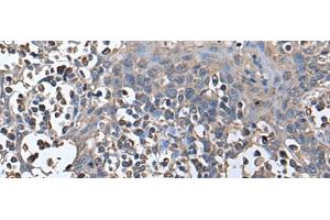 Immunohistochemistry of paraffin-embedded Human tonsil tissue using ZNHIT1 Polyclonal Antibody at dilution of 1:40(x200)