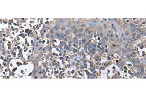 Immunohistochemistry of paraffin-embedded Human tonsil tissue using ZNHIT1 Polyclonal Antibody at dilution of 1:40(x200) (ZNHIT1 anticorps)