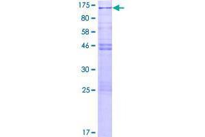 Image no. 1 for CSRP2 Binding Protein (CSRP2BP) (AA 1-782) protein (GST tag) (ABIN1350572)