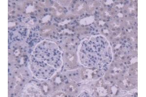 Detection of AGXT2 in Rat Kidney Tissue using Polyclonal Antibody to Alanine Glyoxylate Aminotransferase 2 (AGXT2)