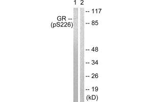 Western Blotting (WB) image for anti-GR (Internal Region), (pSer226), (pSer234), (pSer246) antibody (ABIN1847260) (GR (Internal Region), (pSer226), (pSer234), (pSer246) anticorps)