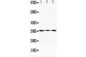 Anti-Apolipoprotein D antibody, (ABIN3042724), Western blottingLane 1: MCF-7 Cell LysateLane 2: HELA Cell LysateLane 3: SMMC Cell Lysate