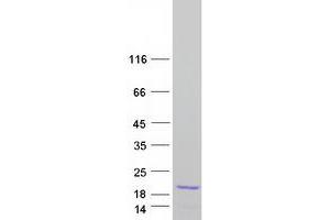 Validation with Western Blot