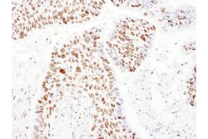 Immunohistochemistry (IHC) image for anti-PSME3 (PSME3) (AA 204-254) antibody (ABIN7454979) (PSME3 anticorps  (AA 204-254))