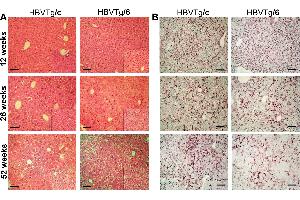 Paraffin-embedded sections of transgenic mice liver were stained with an antibody against HBsAg (ABIN285516). (HBSAg anticorps)