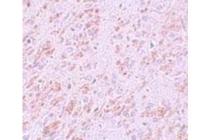 Immunohistochemistry of rat brain tissue with VENTX polyclonal antibody  at 5 ug/mL.