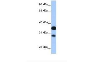Image no. 1 for anti-Cbp/p300-Interacting Transactivator, with Glu/Asp-Rich Carboxy-terminal Domain, 2 (CITED2) (AA 55-104) antibody (ABIN6737774)