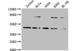 Western Blot Positive WB detected in: Jurkat whole cell lysate, Hela whole cell lysate, A549 whole cell lysate, K562 whole cell lysate, HL60 whole cell lysate All lanes: LMX1A antibody at 1:2000 Secondary Goat polyclonal to rabbit IgG at 1/50000 dilution Predicted band size: 43, 15 kDa Observed band size: 43 kDa (LMX1A anticorps  (AA 9-86))