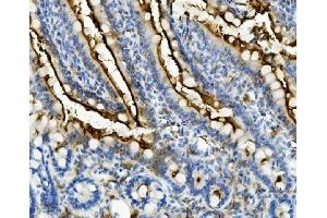 IHC analysis of ANPEP using anti-ANPEP antibody (ABIN7600087). (CD13 anticorps  (AA 148-966))