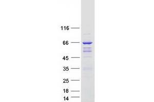 Validation with Western Blot