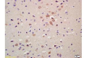 Formalin-fixed and paraffin embedded rat brain labeled with Anti-GRK1 Polyclonal Antibody, Unconjugated (ABIN737391) at 1:200 followed by conjugation to the secondary antibody and DAB staining.