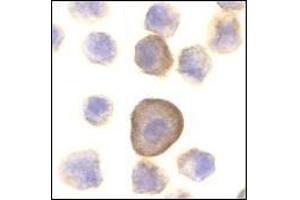 Immunocytochemistry of PERP in A431 cells with this product at 10 μg/ml. (PERP anticorps  (C-Term))