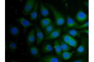 Detection of PZP in Human Hela Cell using Polyclonal Antibody to Pregnancy Zone Protein (PZP)