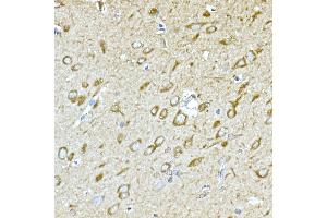 Immunohistochemistry of paraffin-embedded rat brain using GPLD1 Rabbit pAb (ABIN6131716, ABIN6141335, ABIN6141336 and ABIN6222300) at dilution of 1:100 (40x lens). (GPLD1 anticorps  (AA 24-160))