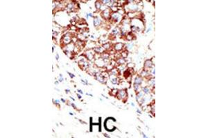 Immunohistochemistry (IHC) image for anti-Protein Inhibitor of Activated STAT, 1 (PIAS1) antibody (ABIN2996746) (PIAS1 anticorps)