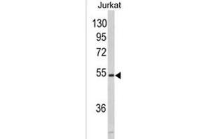 Western blot analysis of MF 928b in Jurkat cell line lysates (35 μg/lane). (MFAP1 anticorps  (N-Term))