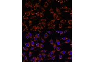 Immunofluorescence analysis of L929 cells using CCDC47 antibody (ABIN7266438) at dilution of 1:100.