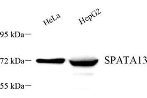 Western blot analysis of SPATA13 (ABIN7075700) at dilution of 1: 500 (SPATA13 anticorps)