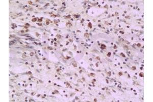 Formalin-fixed and paraffin embedded rat colon tissue labeled with Anti-PAF Polyclonal Antibody, Unconjugated (ABIN737931) at 1:200 followed by conjugation to the secondary antibody and DAB staining (KIAA0101 anticorps)