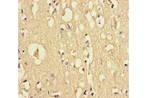 Immunohistochemistry of paraffin-embedded human brain tissue using ABIN7149595 at dilution of 1:100 (DOCK6 anticorps  (AA 499-616))