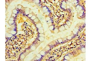 Immunohistochemistry of paraffin-embedded human small intestine tissue using ABIN7173221 at dilution of 1:100 (TMEM44 anticorps  (AA 269-439))