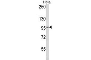 BCL6 Antibody (C-term) western blot analysis in Hela cell line lysates (35µg/lane). (BCL6 anticorps  (C-Term))