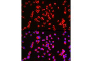 Immunofluorescence analysis of Neuro-2a cells using CTNN Rabbit pAb (ABIN7266134) at dilution of 1:100 (40x lens).