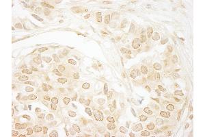 Immunohistochemistry (IHC) image for anti-Protein Phosphatase 3, Catalytic Subunit, alpha Isoform (PPP3CA) (AA 1-50) antibody (ABIN7454686)