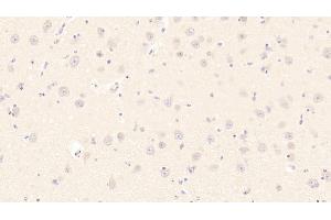 Detection of HSPA1B in Bovine Cerebrum Tissue using Monoclonal Antibody to Heat Shock 70 kDa Protein 1B (HSPA1B)
