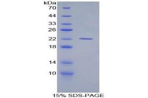 SDS-PAGE analysis of Mouse Aconitase 1 Protein.