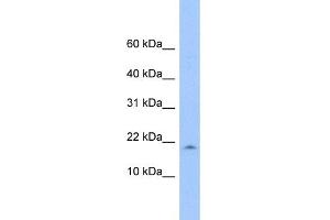 WB Suggested Anti-LOC285033 Antibody Titration: 0. (LOC285033 anticorps  (N-Term))
