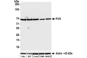 Western Blotting (WB) image for anti-Fused in Sarcoma (FUS) (AA 1-50) antibody (ABIN7454040)