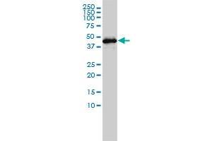 GSDMDC1 monoclonal antibody (M01), clone 3F12-1B2 Western Blot analysis of GSDMDC1 expression in Jurkat . (GSDMD anticorps  (AA 1-484))