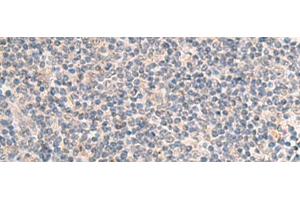 Immunohistochemistry of paraffin-embedded Human tonsil tissue using IDUA Polyclonal Antibody at dilution of 1:35(x200) (IDUA anticorps)