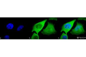 Immunocytochemistry/Immunofluorescence analysis using Rabbit Anti-HO-1 Polyclonal Antibody . (HMOX1 anticorps  (PE))