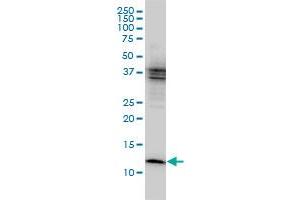 CSTB monoclonal antibody (M01), clone M1-C1 Western Blot analysis of CSTB expression in MCF-7 .
