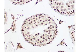Immunohistochemistry of paraffin-embedded rat testis using MCM5 Rabbit mAb (ABIN7268543) at dilution of 1:100 (40x lens). (MCM5 anticorps)