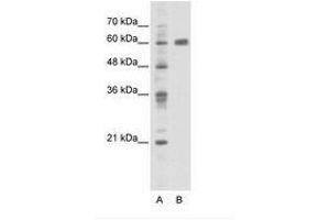 Image no. 1 for anti-PDZ and LIM Domain 5 (PDLIM5) (C-Term) antibody (ABIN202798) (PDLIM5 anticorps  (C-Term))