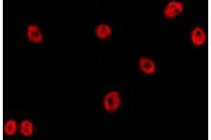 ABIN6278648 staining HepG2 by IF/ICC. (ZNF23 anticorps)